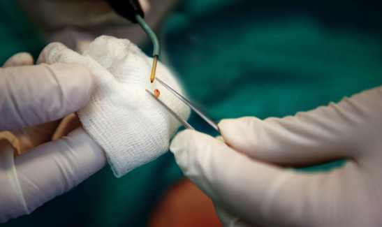 柔性電路板之醫(yī)療電子如何滿足市場(chǎng)的發(fā)展與需求